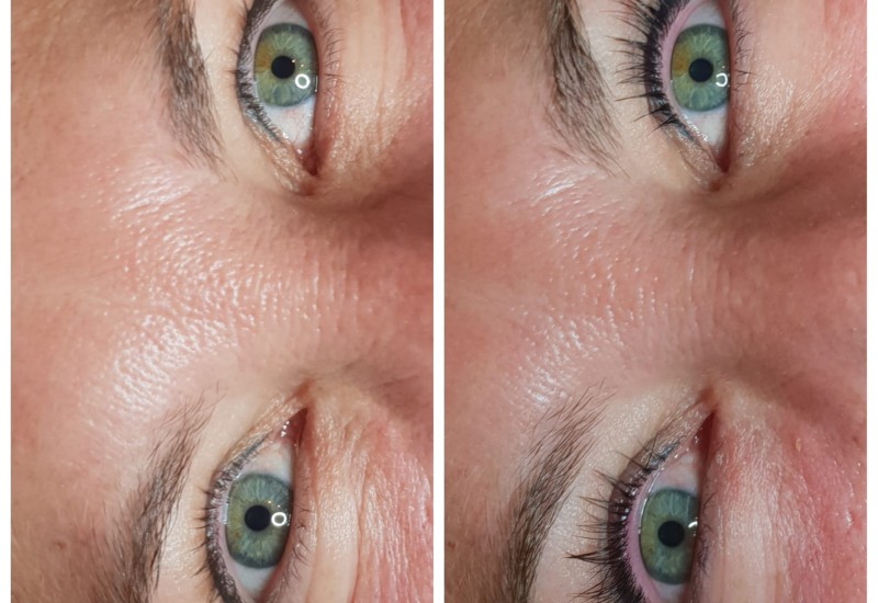 Lashlifting