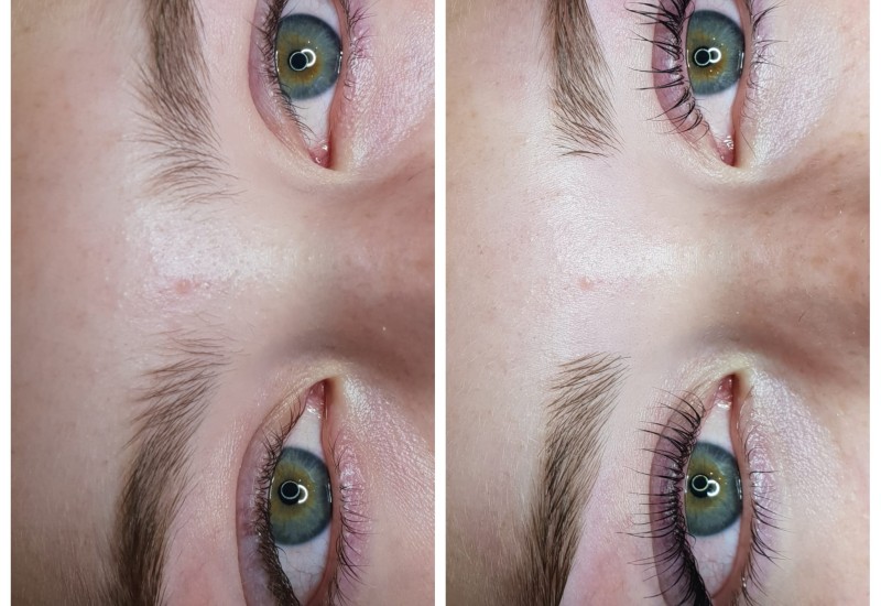 Lashlifting