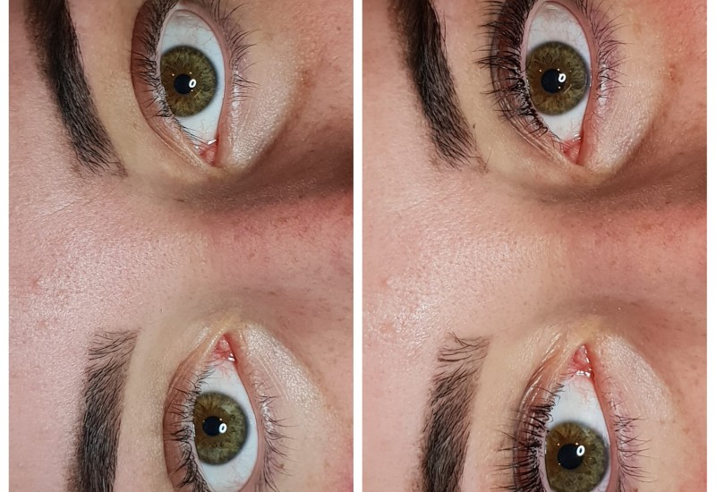 Lashlifting