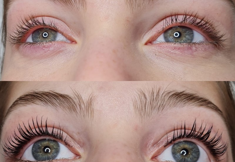 Lashlifting