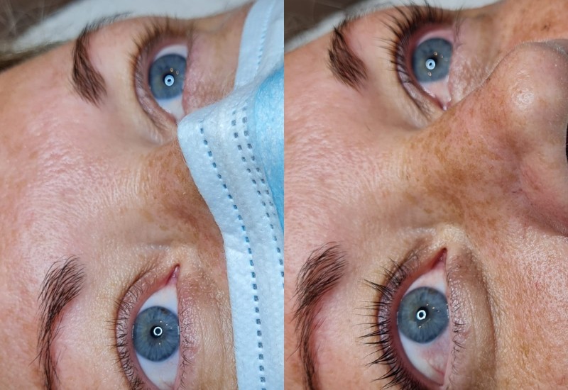 Lashlifting
