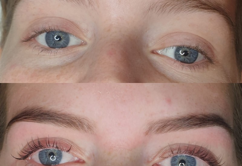 Lashlifting