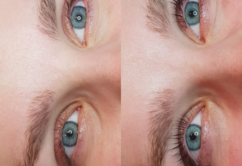 Lashlifting