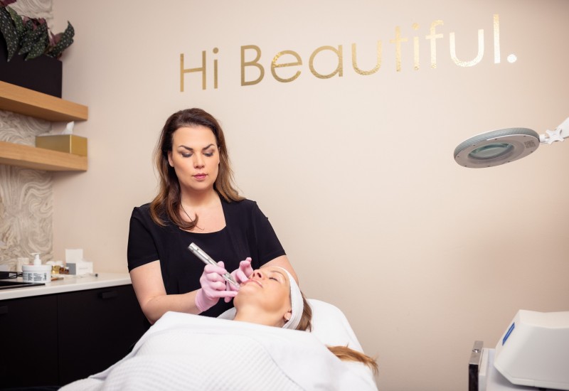 Microneedling