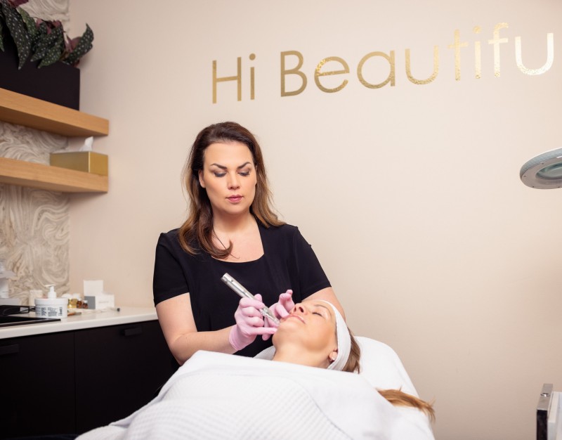 Microneedling